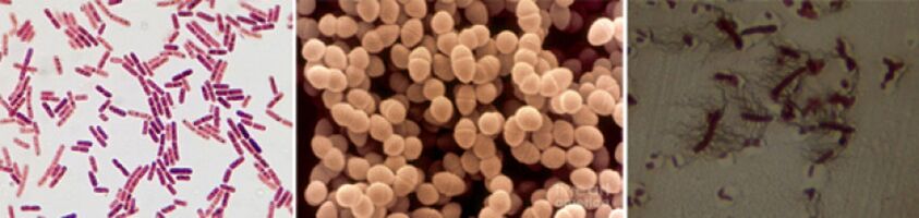 Escherichia -Sticks, Faecalicocci et Pro - Le principal pathogène de la prostatite bactérienne chronique