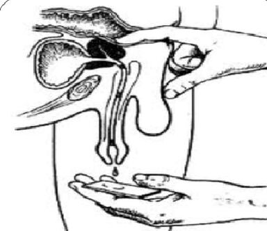 Masser la prostate pour obtenir des sécrétions