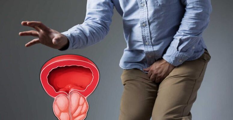Prévention de la prostatite et de la prostate -adénome